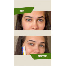 Крижана дренажна есенція для зони навколо очей Crystal Ice Essence Liquid Eye Patch Malevich