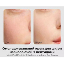 Омолоджуючий крем для шкіри навколо очей з пептидами Medi-Peel Peptide 9 Hyaluronic Volumy Eye Cream, 40 мл