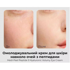 Омолоджуючий крем для шкіри навколо очей з пептидами Medi-Peel Peptide 9 Hyaluronic Volumy Eye Cream, 40 мл