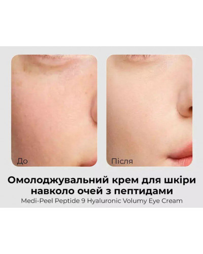 Омолоджуючий крем для шкіри навколо очей з пептидами Medi-Peel Peptide 9 Hyaluronic Volumy Eye Cream, 40 мл