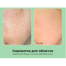 Сироватка-шот Medi-Peel Phyto Cica Nol B5 3000 Shot