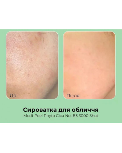 Сироватка-шот Medi-Peel Phyto Cica Nol B5 3000 Shot