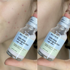 Локальний засіб проти прищів і почервоніння (болтушка) HOLLYSKIN Calamine. Drying Lotion 15 мл