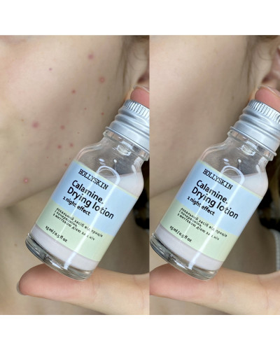 Локальний засіб проти прищів і почервоніння (болтушка) HOLLYSKIN Calamine. Drying Lotion 15 мл