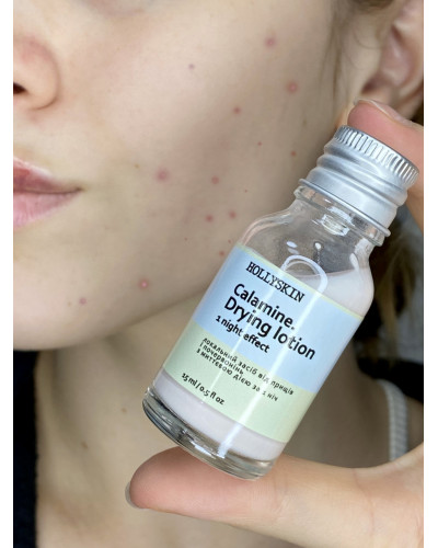 Локальний засіб проти прищів і почервоніння (болтушка) HOLLYSKIN Calamine. Drying Lotion 15 мл
