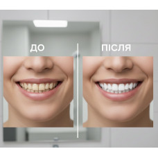 Відбілювальна зубна паста для чутливих зубів Medosan SensiWhite